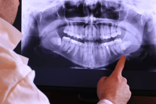 Best After-Hours Dental Trauma Care in Chouteau, OK