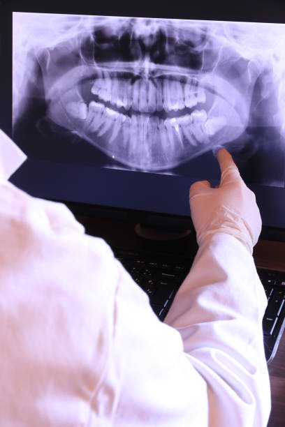 Best Emergency Tooth Extraction in Chouteau, OK