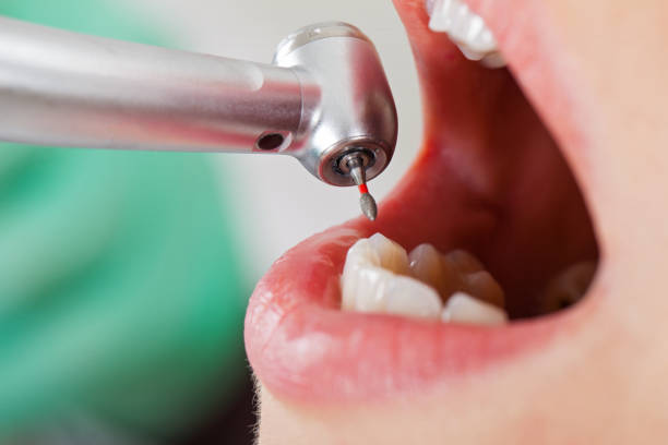 Best Emergency Denture Repair in Chouteau, OK